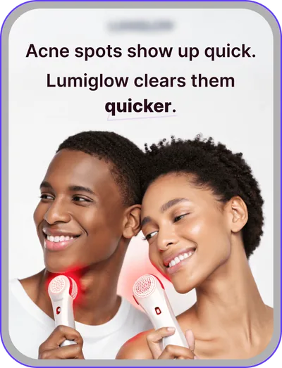 Ad design: light therapy device that clears acne